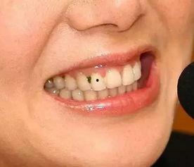 口腔视频教程,掌握口腔健康护理技巧